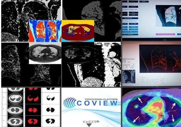 خبرنگاران فناوران اردبیلی سامانه هوشمند پردازش تصاویر پزشکی ساختند